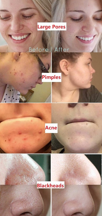 Diystar™Natural Green Tea Clay Mask Stick– Clears Acne & Refines Pores🌿