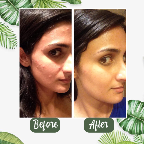 Diystar™Natural Green Tea Clay Mask Stick– Clears Acne & Refines Pores🌿