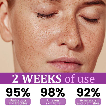 LOVILDS™ MelantraX Advanced Anti-Hyperpigmentation Essence