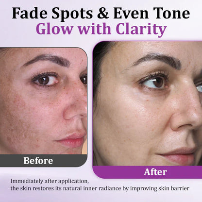 LOVILDS™ MelantraX Advanced Anti-Hyperpigmentation Essence